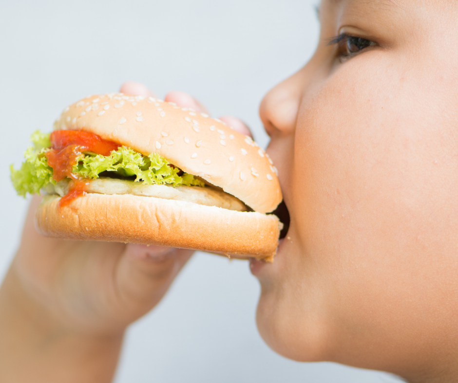 Obesidade infantil: veja as causas e como prevenir esse problema